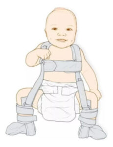 Arnes De Pavlick Displasia Cadera Niños Infantil Ortopedia - Imagen 10